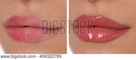 Collage With Photos Of Woman With Dry And Moisturized Lips, Closeup. Banner Design