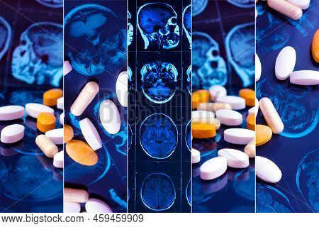 Different pharmaceutical medicine pills on magnetic brain resonance scan mri background collage. Pharmacy theme, health care, drug prescription for tumor, alzheimer, mental illness treatment.