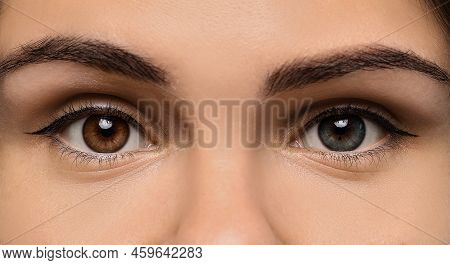 Woman With Beautiful Eyes Of Different Colors, Closeup. Heterochromia Iridis