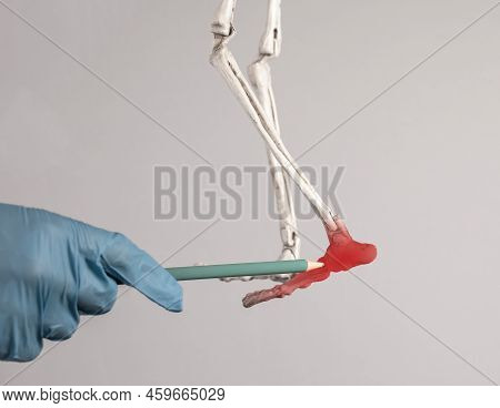 Doctor Hand Pointing To Human Skeleton Foot With Red Point. Heel, Ankle, Forefoot Pain. Injury, Exce