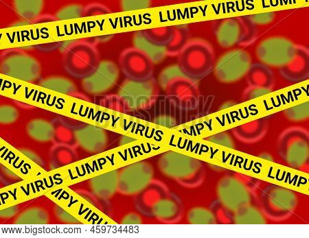 Lumpy Virus Yellow Crime Spot Line On Blur Pox Virus In Human Body. Heath Care Awareness Illustratio
