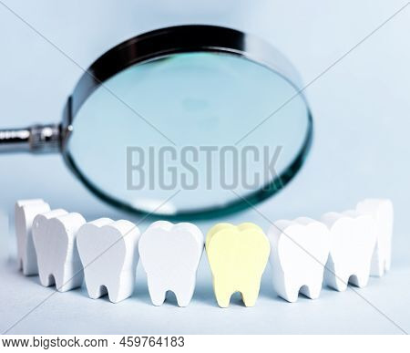 One Tooth With Caries, Detection Of Unhealthy Teeth. High Quality Photo