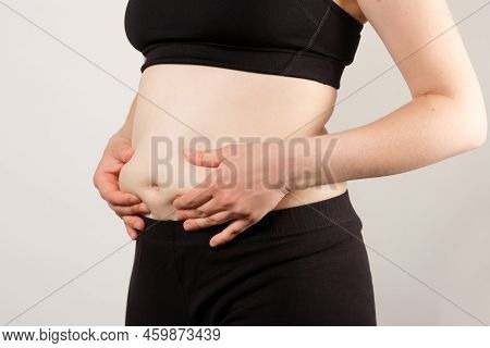 A Woman Shows An Inflated Thick Belly, The Concept Of Excess Weight And Weight Loss.