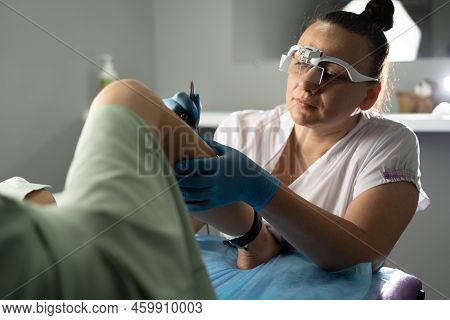 Doctor Hair Removal Specialist Making Electro Epilation Hair From Womans Legs. Cosmetology Procedure