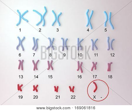 Turner s-syndrome karyotype, labeled. X0 karyotype. 3D illustration