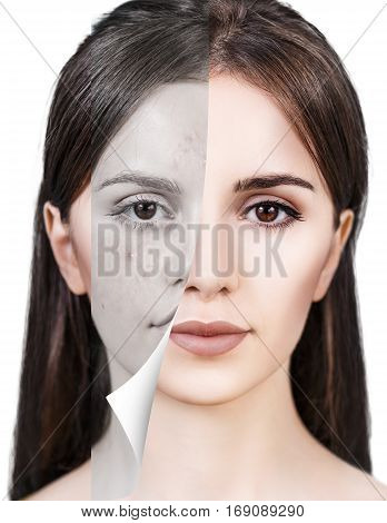 Layer with bad skin unstick from good healthy skin.