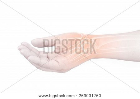 Wrist Bones Injury White Background Wrist Pain