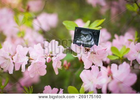 Ultrasound Of A Baby On Flowering Branch Of Ledum