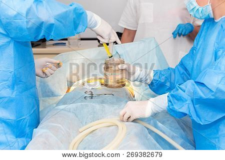 Surgical Team Performing Cosmetic Surgery In Hospital Operating Room. Surgeon Working On A Patient. 