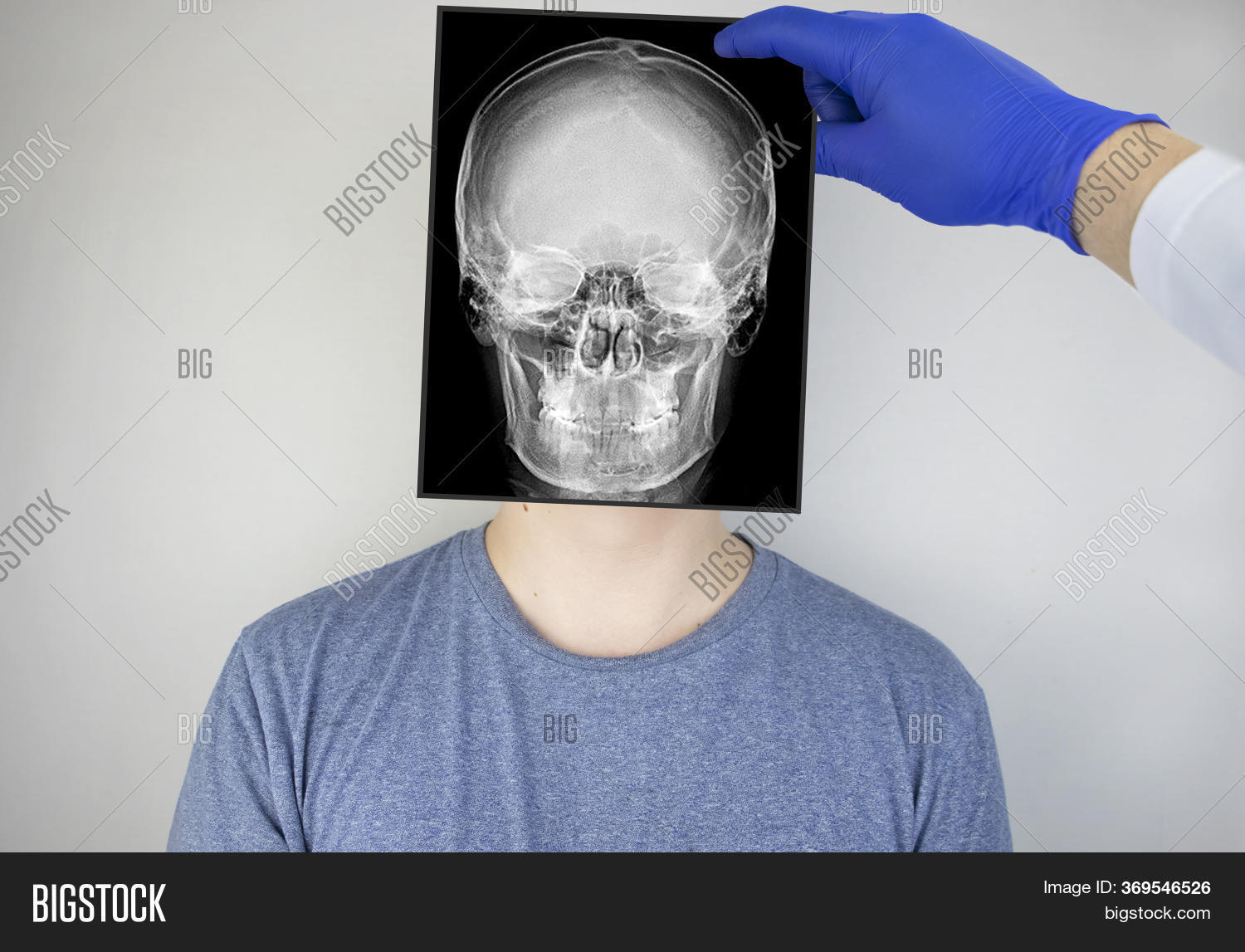 Survey Radiography Image & Photo (Free Trial) Bigstock
