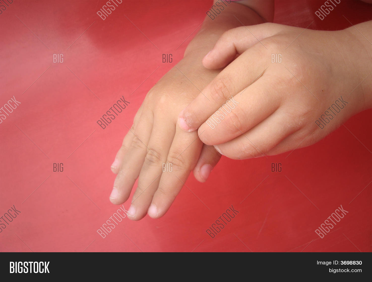 Скабиозная лимфоплазия (узелковая чесотка). Красивые кисти рук у девушек. Женщина показывает запястье. Почему чешутся руки на запястьях. Красивые запястья фото.