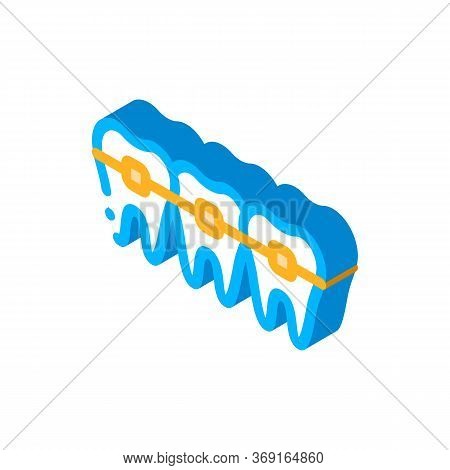 Dentist Stomatology Teeth Braces Vector Isometric Sign. Color Isolated Symbol Illustration