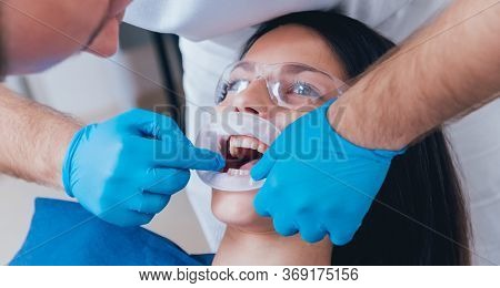 Installation Of The Expander, Preparation For The Photo Protocol