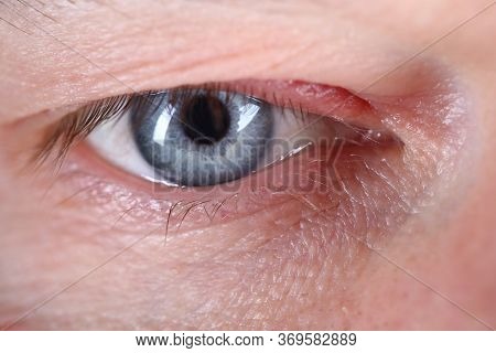 Contented Gaze Man, Close Up Human Eye European. Mens Cream For Skin Around The Eyes. Male Eye Is Bl