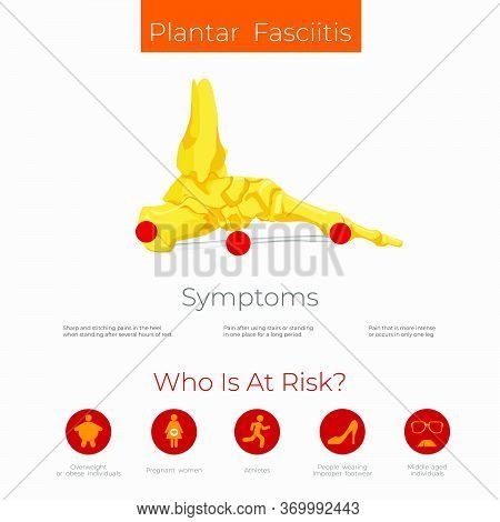 Plantar Fasciitis Anatomy Scheme. Leg Pain. Poster