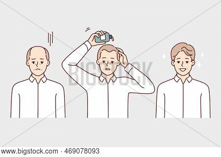 Man Using Hair Growth Gel Rejoices After Seeing Good Result Of Cosmetic Product. Sad Guy Uses Cream 
