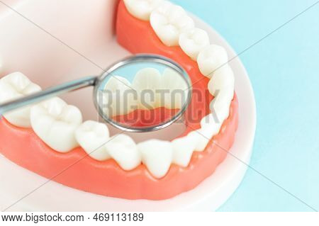 Dentistry Conceptual Photo. Close-up Individual Tooth Tray Orthodontic Dental Theme. Dentistry Conce