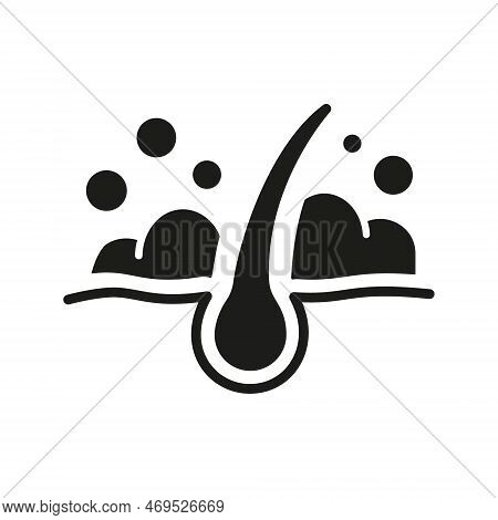 Hair Wash Silhouette Icon. Follicle Washing With Shampoo And Foam Black Pictogram. Treatment Of Hygi