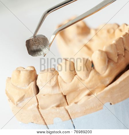 Technical shots on a dental prothetic laboratory