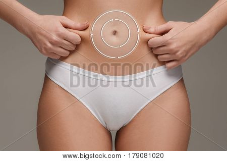 Women belly with the drawing arrows. The cellulite removal plan. White markings on young woman body preparing for plastic surgery. Concept of slimming, liposuction, strand lifting