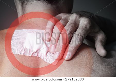 A Wound Stuck On The Back Of A Man After Removal Of A Fibroma, A Birthmark. Close-up, Toned