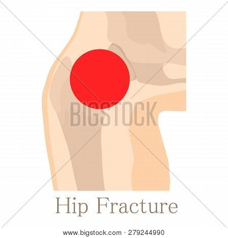 Hip Fracture Icon. Cartoon Illustration Of Hip Fracture Icon For Web Isolated On White Background