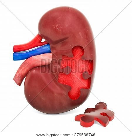 Kidney Disease Or Infection Concept, 3d Rendering Isolated On White Background