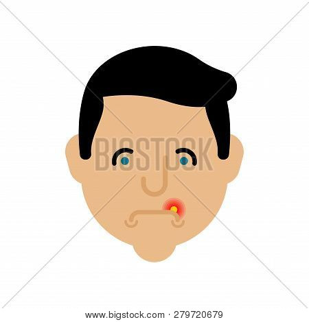 Herpes On Lip Man. Cold On Mouth Male