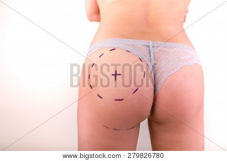 Cellulite Cut Out. Conceptual Image, Plastic Surgery Concept. Conceptual Image, Plastic Surgery Conc