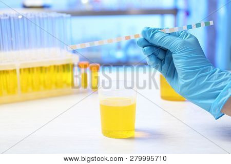 Laboratory Assistant Doing Analysis With Urine Sample And Litmus Paper On Table, Closeup