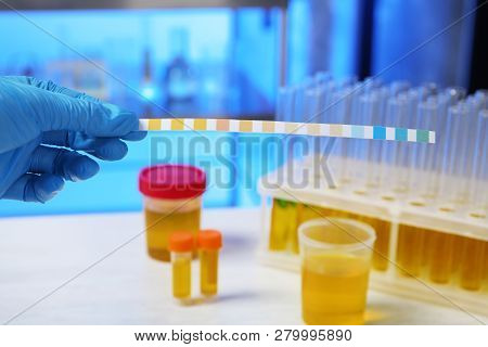 Laboratory Assistant Holding Litmus Paper For Analysis Over Table, Closeup