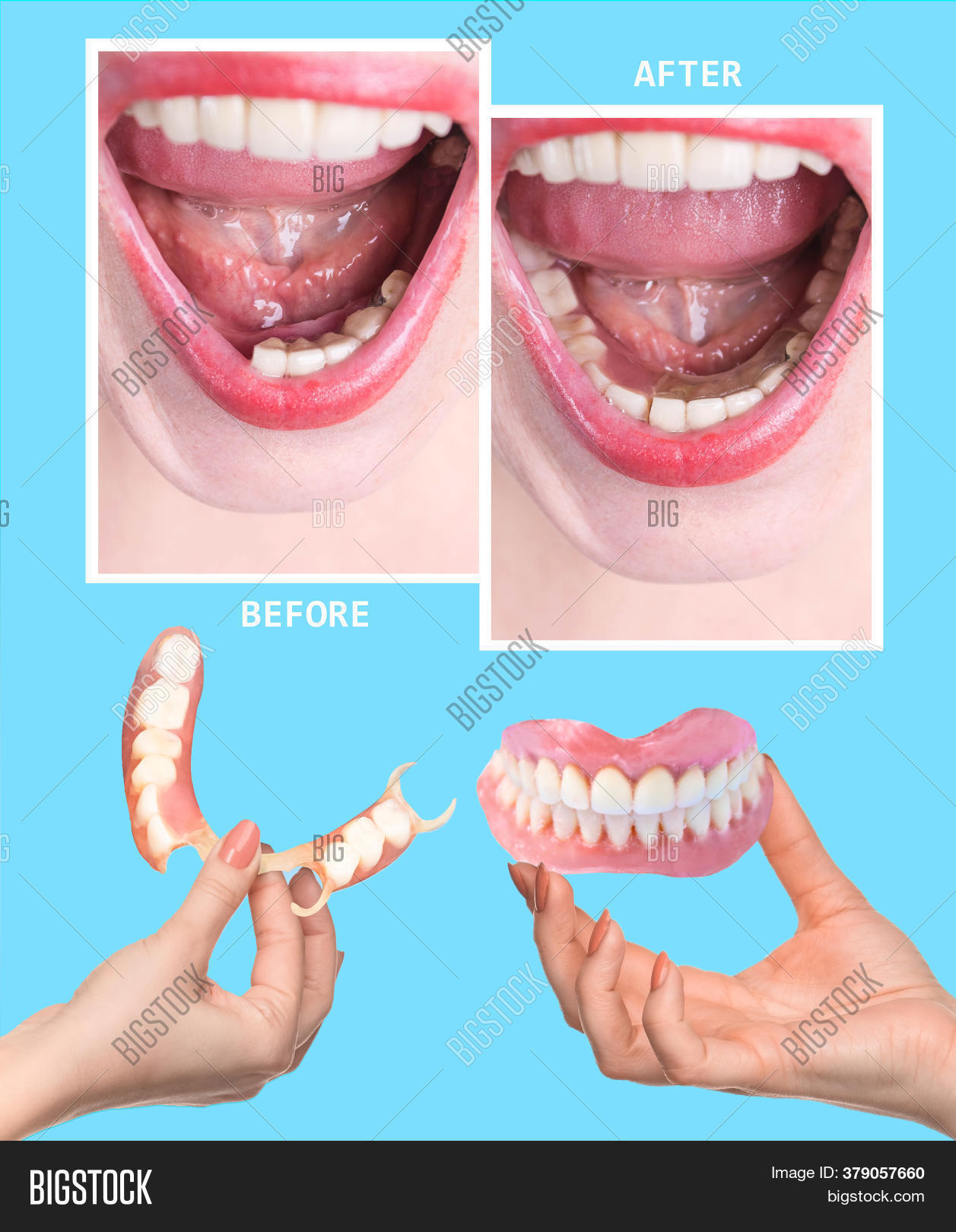 Dental Rehabilitation Image & Photo (Free Trial) Bigstock