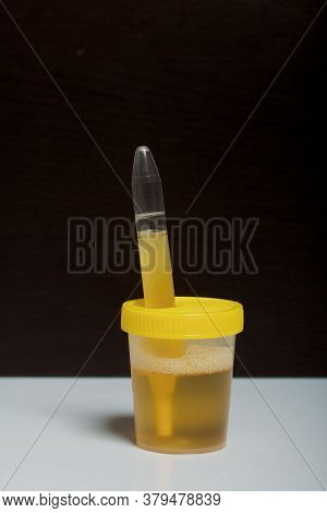 Urine Flows From The Assay Container Into A Vacuum Tube. Disposable Medical Polymeric Sterile Contai