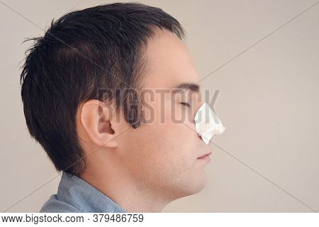 Man Puts On And Removes A Strip For The Nose From Black Dots. Coal Cleaning Strips From Blackheads A