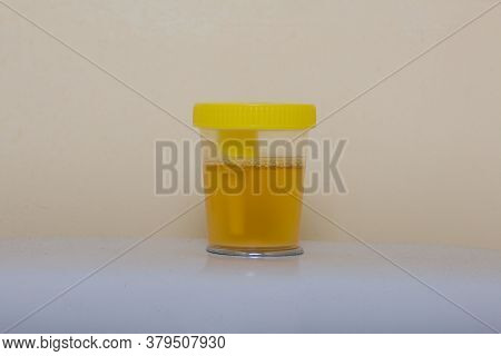 Urine In A Container For Analysis. Stands On The Toilet Cistern. Disposable Medical Polymeric Steril