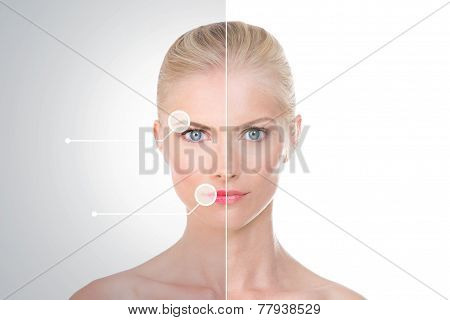 Treatment Before And After On Nordic Beauty