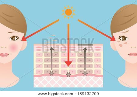 diagram of skin spots. skin care concept