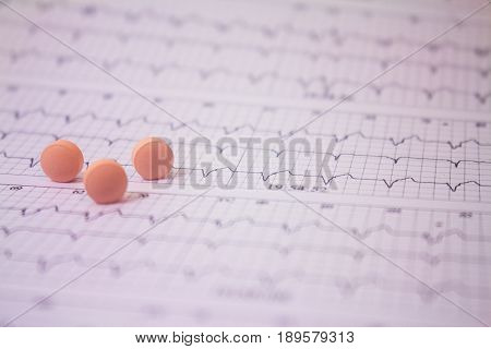 Electrocardiogram chart holter of a patient with pacemakers and some pills