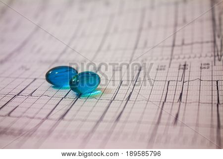 Holter electrocardiogram trace of a patient with pacemakers and some colored pills
