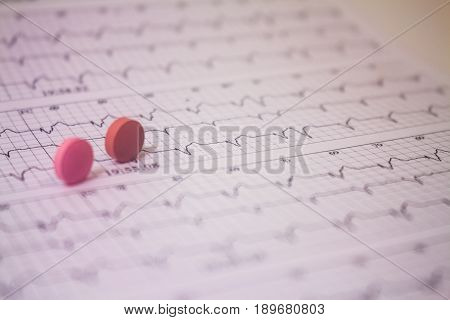 Background of a three-channel holter electrocardiogram of a patient with cardiac pacemaker and two pills