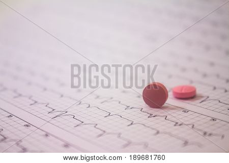 Background of a three-channel holter electrocardiogram of a patient with cardiac pacemaker and two pills