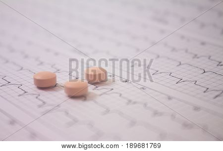Background of a three-channel holter electrocardiogram of a patient with cardiac pacemaker and three pills