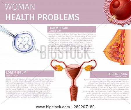 Woman Health Problems. Detailed Cross Section Of Female Breast, Uterus Front View And Fertilized Egg