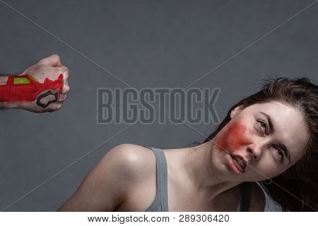 The Concept Of A Car Accident, An Insured Event . Painted Car On A Man's Fist, Knocks The Girl Down 