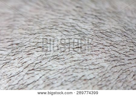 Short Hair On A Head Close Up. Scalp Man's Head. Baldness. Bald Man. Problems With Hair Growth On Th
