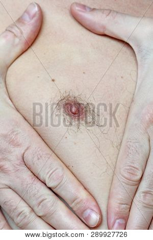 Male Hairy Nipple. Nipple With Hair. Easy Erotica And Humor. Without Epilation. Male Hand. Bdsm