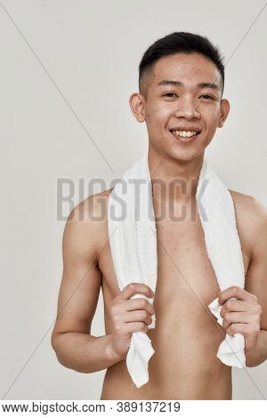 Portrait Of Shirtless Young Asian Man With Problematic Skin And Hyperpigmentation On His Face Posing