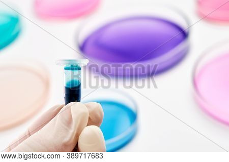 Eppendorf Tube With Blue Liquid In The Hand Of Scientist On The Background Of Petri Dishes For Micro