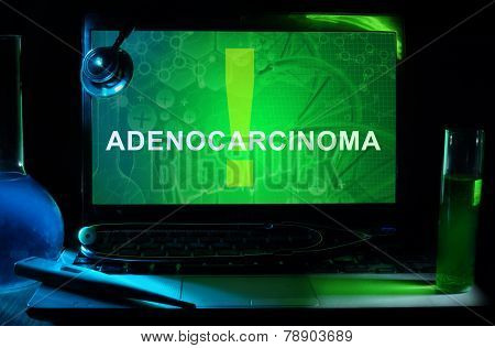 Notebook with words Adenocarcinoma