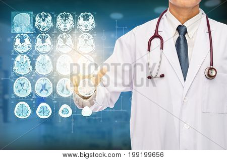 Radiologist doctor touching film brain MRI at hospital.